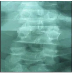 Fig. 3. CT Scan neck image  