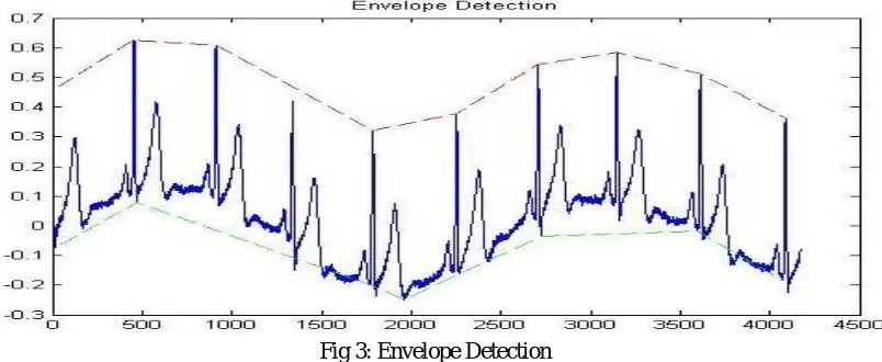 Fig 3: Envelope Detection 