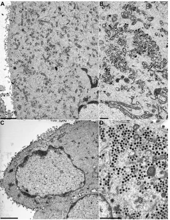 FIG. 6. Ultrastructural analysis of PrV-UL36�analyzed 14 h after infection. (A) Overview of a PrV-UL36C) and 1cytoplasm