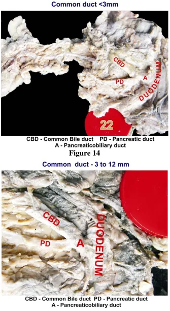 Figure 14   