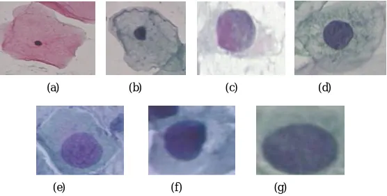 Fig. 2. General Structure of MLP 