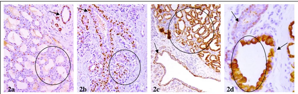 Fig 1. Structural variations in myoepithelial cell layer between the lobular and ductal systems