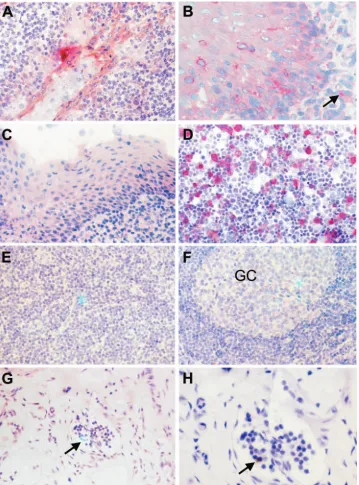 FIG. 1. Detection of replication-deﬁcient viral vectors in the lymphoid tissue. (A and B) GFP expression after tonsillar administration of anadenoviral vector (Ad-GFP) was detected by immunohistochemistry (red) in the crypt (A) and squamous epithelium (B) 