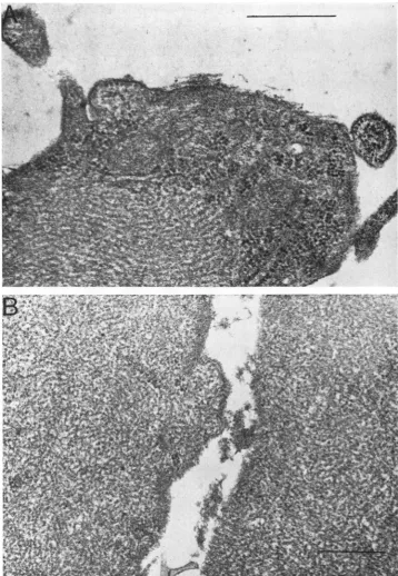 FIG. 10.(B) Electron microscopy of Sendai virus-infected chick embryo fibroblasts. Cells at 18 hr (A) and 4 days were preparedfor electron microscopy as described in the text