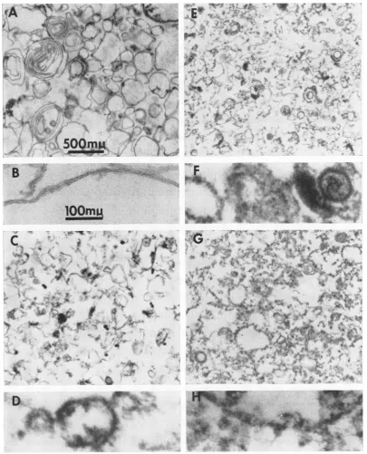 FIG. 2.in2-F; A. Electron micrographs of thin sections of material found in fractions 2-P through S-P
