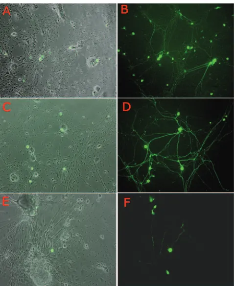 TABLE 2. Expression of the GFP transgene from d109 inneurons over timea