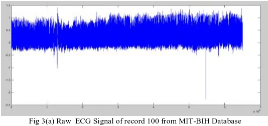 Fig 3(a) Raw  ECG Signal of record 100 from MIT-BIH Database 