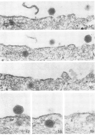 FIG. 14-16.section,inThis Fig. Serial sections. Note the diffuse appearance of the intracytoplasmic virion on the left of Fig