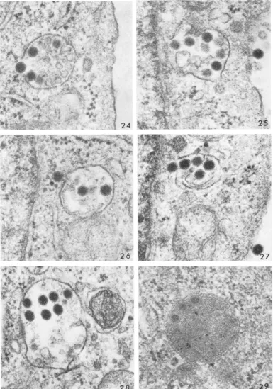 FIG. 25-27.