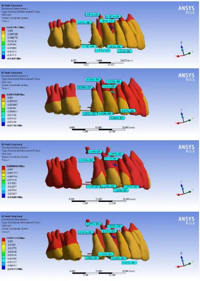 FIGURE 10a: GROUP C , TOOTH DEFORMATION IN Y-AXIS 