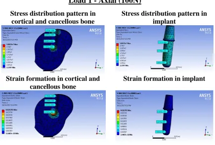 Fig 8(a):  Stress and strain analysis in 3.5x10mm implant  