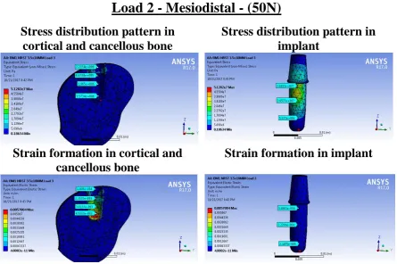 Fig 8 (c):  Stress and strain analysis in 3.5x10mm implant  