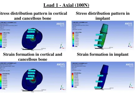 Fig 9 (b):  Stress and strain analysis in 4.3x10mm implant  