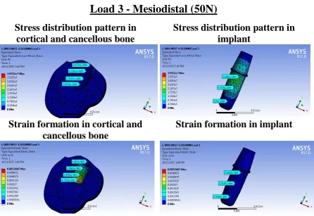 Fig 10 (a):  Stress and strain analysis in 3.5x11.5mm implant Load 1 - Axial (100N) 