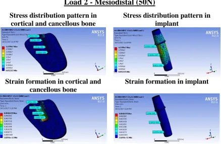 Fig 10 (b):  Stress and strain analysis in 3.5x11.5mm implant Load 2 - Buccolingual (50N) 