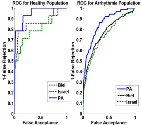 Figure 4: ROC performance curve 