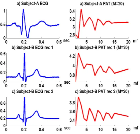 Figure 5:  Pulse Active Transformation for on ECG signals 