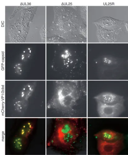 FIG. 2. UL25 is required for VP1/2cbd localization to capsid as-semblons. Vero cells were transfected with the PRV mCherry-VP1/
