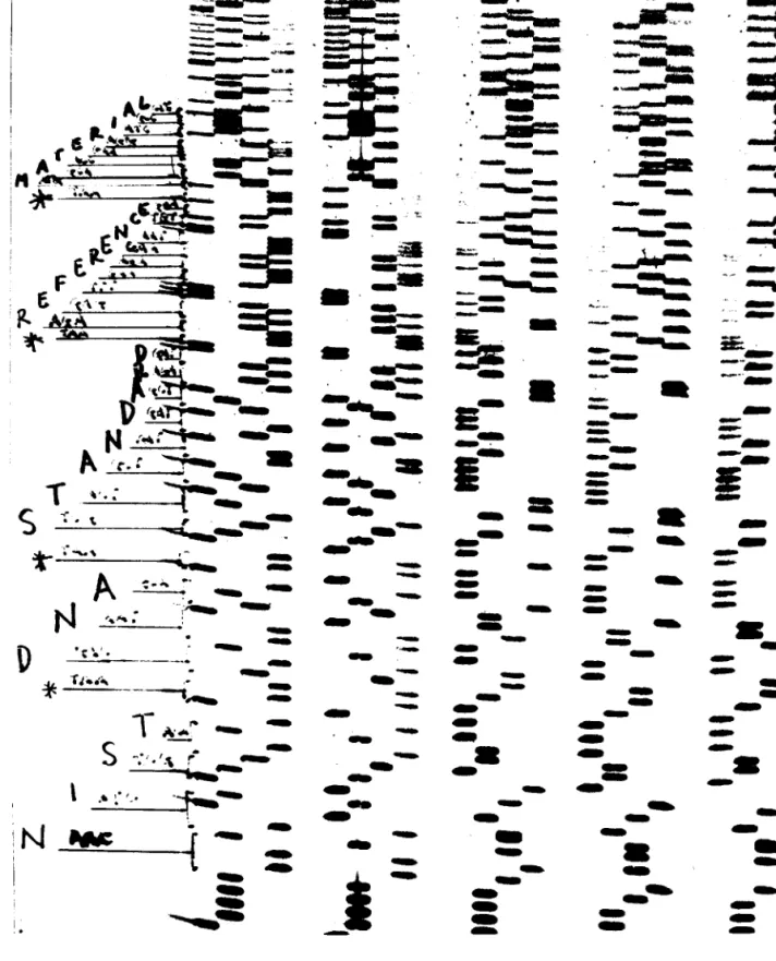 Fig. 4. An autoradiographic image of a DNA sequencing gel. The DNA sequence is determined by ‘‘reading’’ the length and position of each DNA molecule