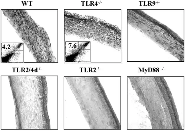 Fig. 4, inﬁltration of Gr1, CD11b, CD11c, and F4/80 cellswas reduced in the TLR2�/� and MyD88�/� animals