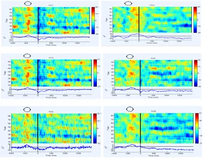 Fig 3. ERP map for Left hand movement 