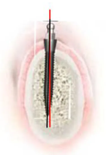 FIGURE 10: PICTORIAL REPRESENTATION 