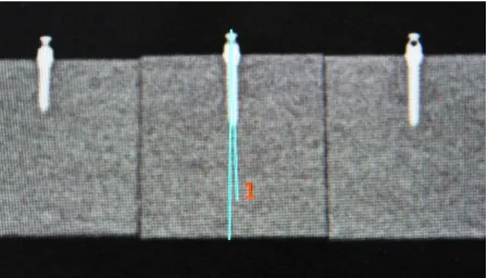 FIGURE 11:  ANALYSIS OF RADIOGRAPHIC IMAGE 