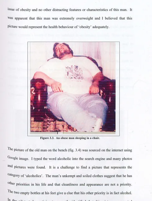 Figure 3.3. An obese man sleeping in a chair. 
