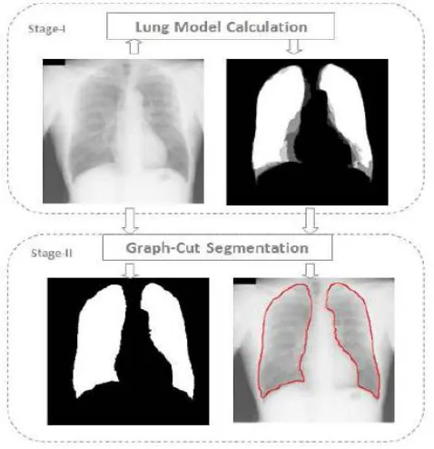Fig. 2. Segmentation process 