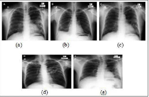 Fig. 3. Examples of normal CXRs used for training 