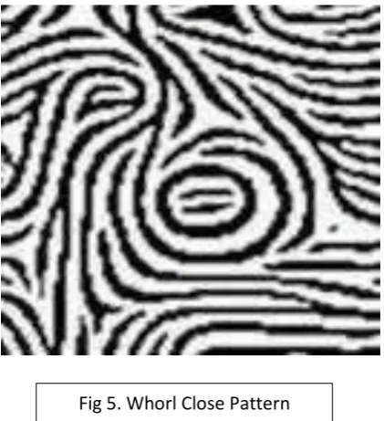 Fig 4. Whorl Open Pattern  