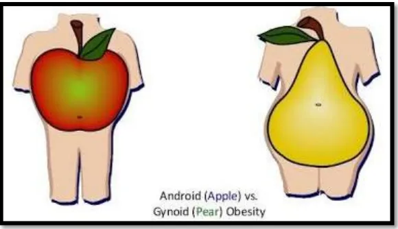 Figure 3 Types of obesity 