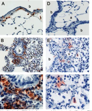FIG. 3. Lung dendritic cell location after �7 days postinfection (B and E). Serial sections were stained with anti-CD11c (left panels) or anti-mPDCA-1 (right panels) as described in Materialsand Methods