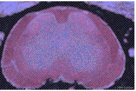 Figure 2.3: A visualization of a mouse spinal cord using painterly ellipses to represent the data; the image allowsvariation of the underpainting lightness, the spacing of an underlying checkerboard pattern, and the major-minoraxis ratio, the major axis direction, the red saturation, and the texture frequency of each ellipse