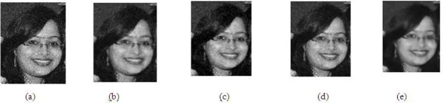 Fig. 4. (a) Gaussian noise attenuated gray image1 (b) image1 after 5×5 mean filtering (c) image1 after 5×5 median filtering (d) image1 after 5×5 adaptive Wiener filtering (e) image1 after 11×11 adaptive Wiener filtering 