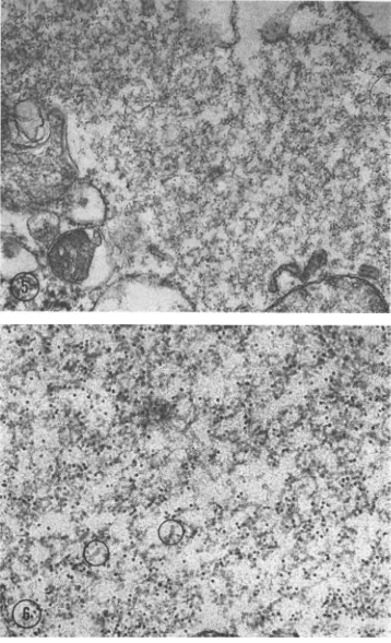 FIG. strands are visible, and the fe,ireas, cell indicated componelnts by circles, are free yielded from ferritint