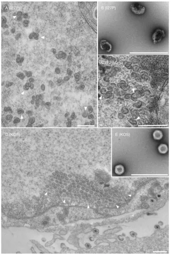 FIG. 3. Mutations at amino acids I27 and F39. Vero cells were infected with KOS (D and E) and the I27P (A and B) and F39H (C) mutantviruses