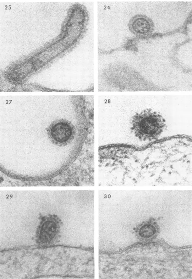 FIG. 37-38.was The surface of an entodermal cell with attached virus. Negative stain. Virus adsorption to CAM for 1 hr at 4 C
