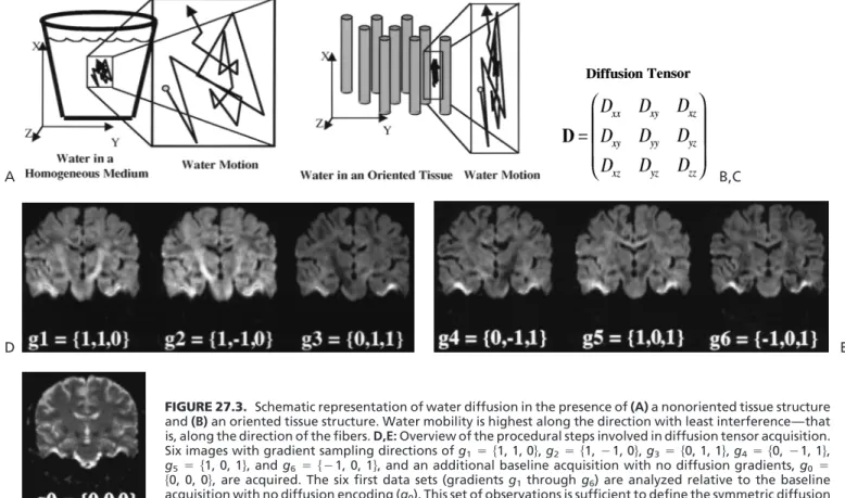 FIGURE 27.3. Schematic representation of water diffusion in the presence of (A) a nonoriented tissue structure and (B) an oriented tissue structure