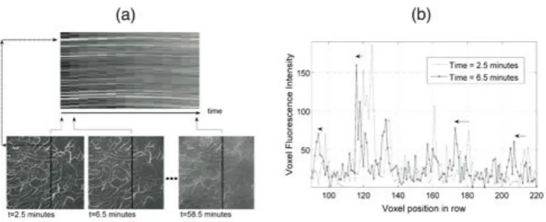 Figure 2. (a) A time-cut (top image) to illustrate the tissue movement with time of one 