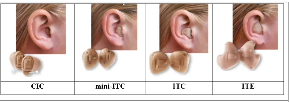 Figure 1.  Major anatomical features of the outer ear. 
