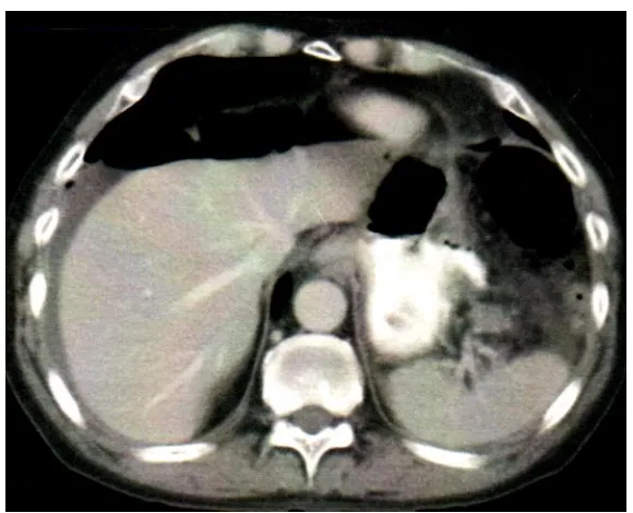 Fig.10 CT abdomen 