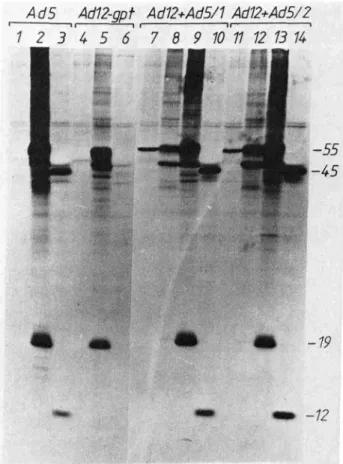 Figure 1 SDS-polyacrylamide gel electrophoresis of proteins immunoprecipitated from extracts of [35S]meth ionine-labeled cells with normal rat serum (lanes 1, 4, 7, and 11 ), Ad5 anti-T serum (lanes 2, 9, and 13), Ad 12 anti-T serum (lanes 5, 8, and 12), a