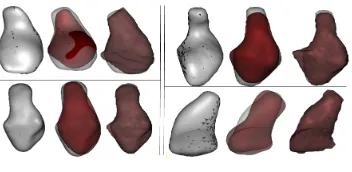 Fig. 8. (Each Quadrant)Left: GT detailed shape; Middle: Estimated detailed shape before evolution;Right: Estimated Detailed Shape after evolution (all are superimposed on the GT shape).