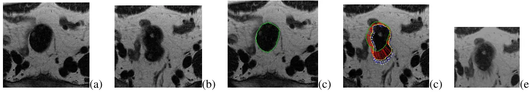 Fig. 3.A 2D MR image pair at different slice levels (a,b). The structure’s deformation is recovered by the Eqns