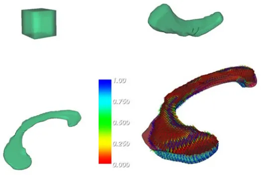 Fig. 7.Evolution of the surface over the corpus callosum (top row and bottom left) along with the estimated vector ﬁeld from the ﬁrst