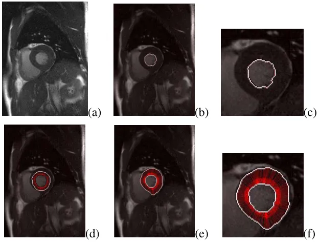 Fig. 11.Myocardium image shown at end-systole phase in (a). When there are no constraints on the vector ﬁeld estimation, the result of