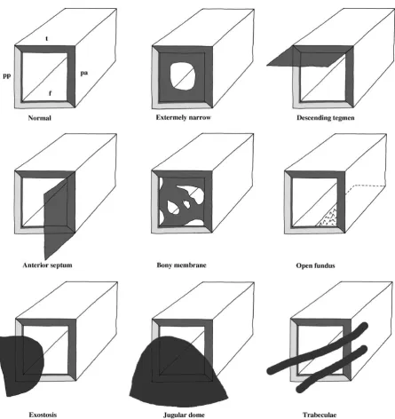 Figure 6; Various types of round window. 