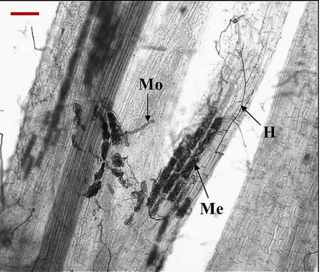 Figure 3.11: Root colonisation by dark septate endophytes (DSE) of Fragaria x ananassa of cv