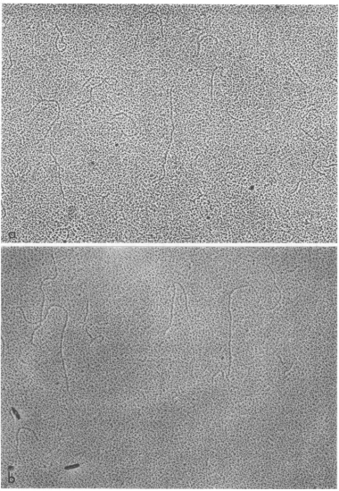 FIG. 9.thewere Replicative intermediate treated with ribonuclease A (0.08 pg/ml, 10 min, 37 C) followed by removal of enzyme by phenol extraction: (a) spread in the absence ofurea; (b) spread in the presence ofurea